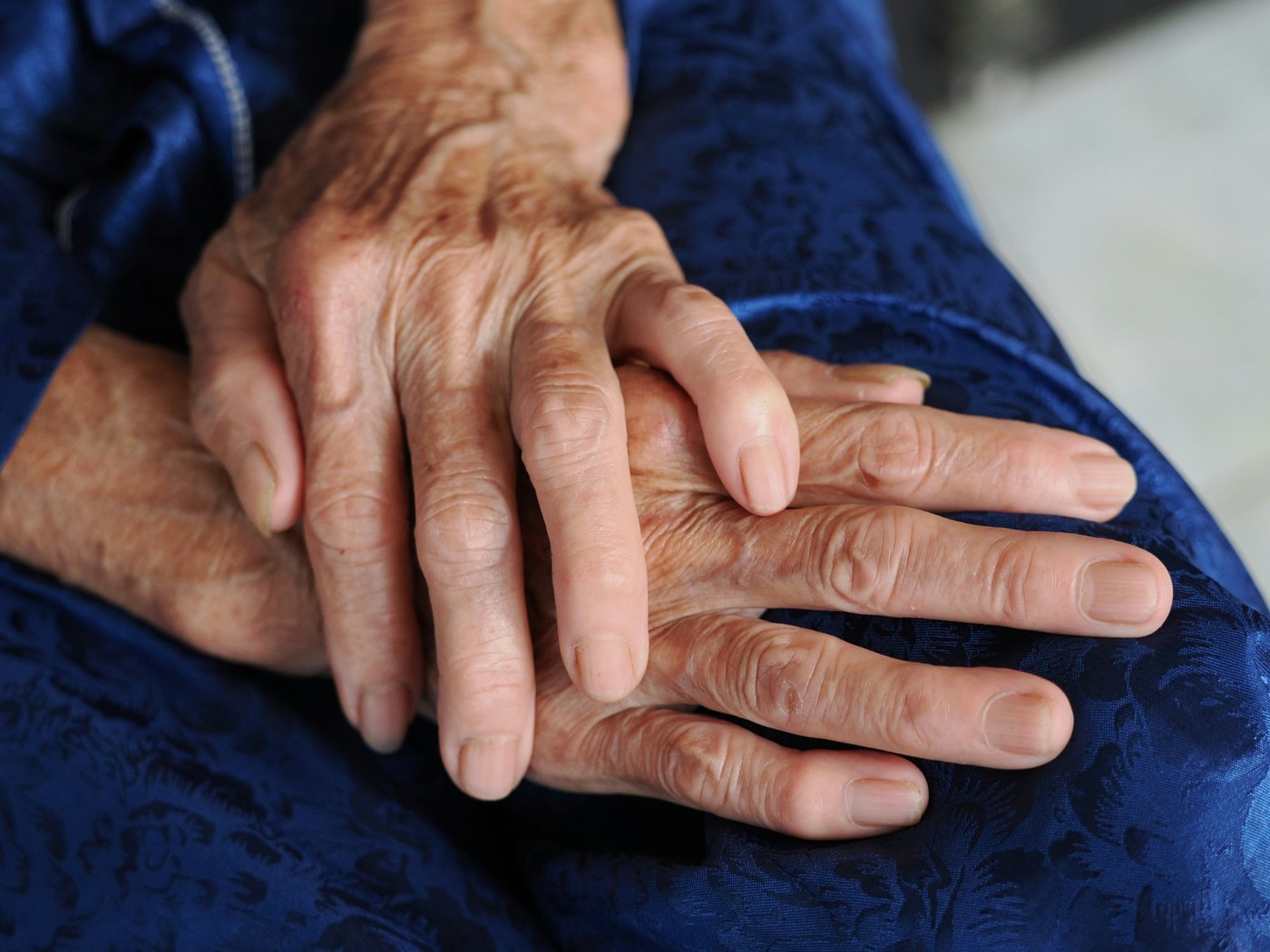 Arthritic pain treatment Blackpool